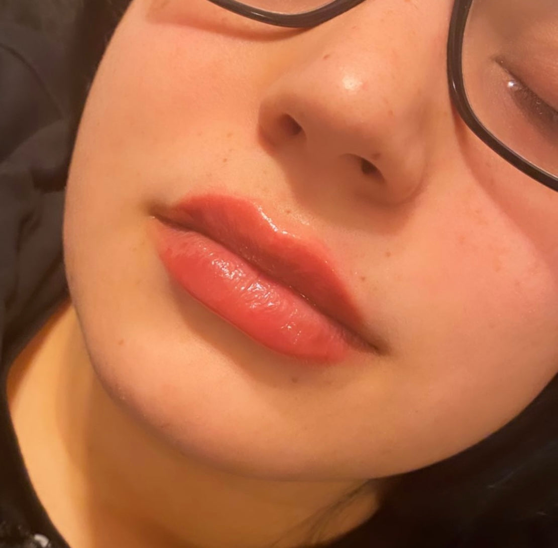 Copy of Hyaluron Pen Lip Fillers-2 syringes