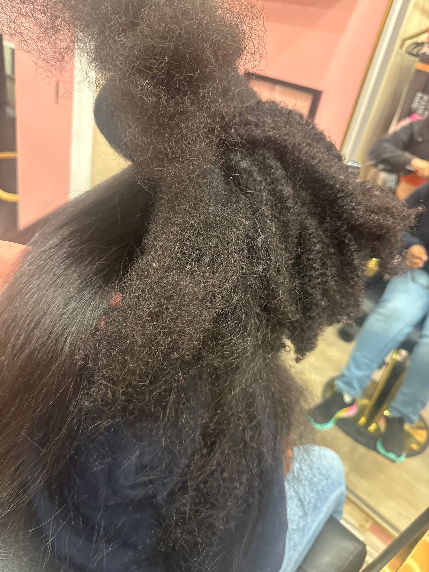 Dematting Consultation